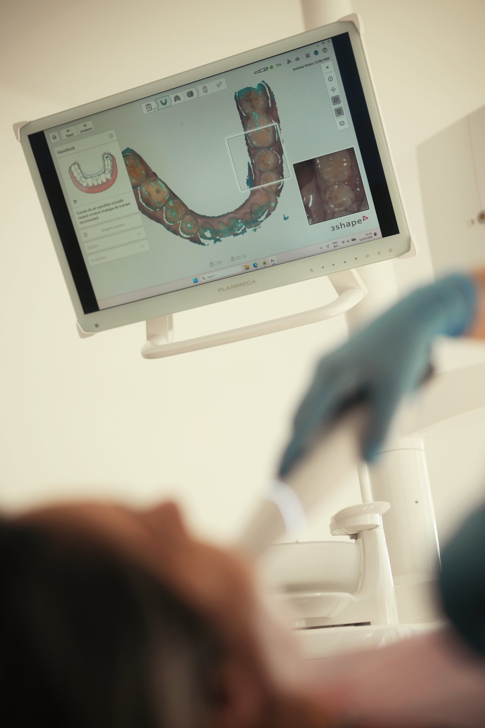 Scanner intraoral 3Shape TRIOS 6